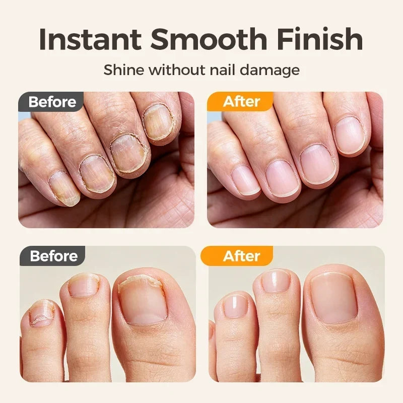 🔥Last Day 40% OFF -✂️ 2-in-1 Smart Electric Nail Clipper & Polisher – Anti-Pinch Safety & LED Light 💅